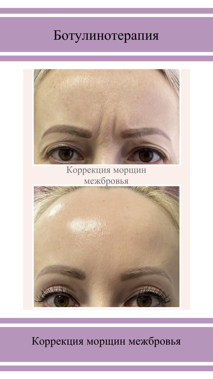 Портфолио