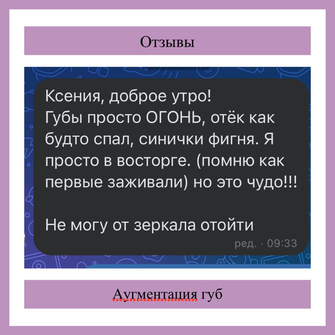 Отзыв