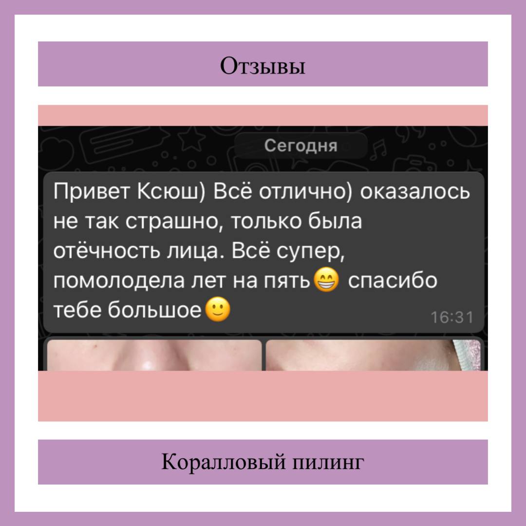 Отзыв